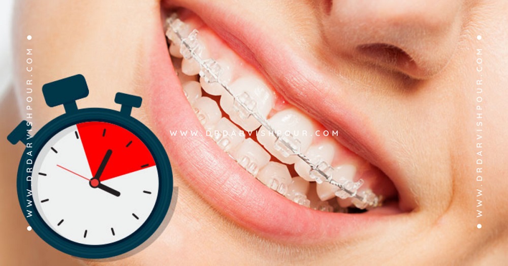 قیمت ارتودنسی سریع